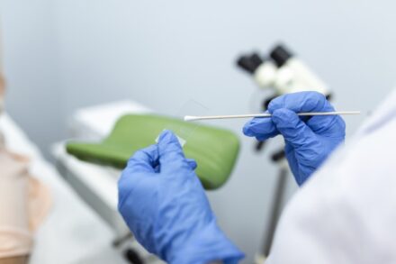 Médico realizando exame preventivo na mulher na menopausa, foco na mão e instrumentos laboratoriais. 