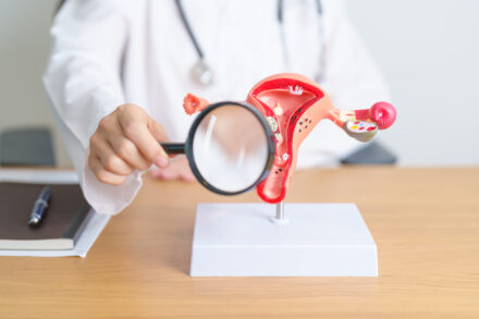 Modelo anatômico do útero, em referência ao câncer no climatério.